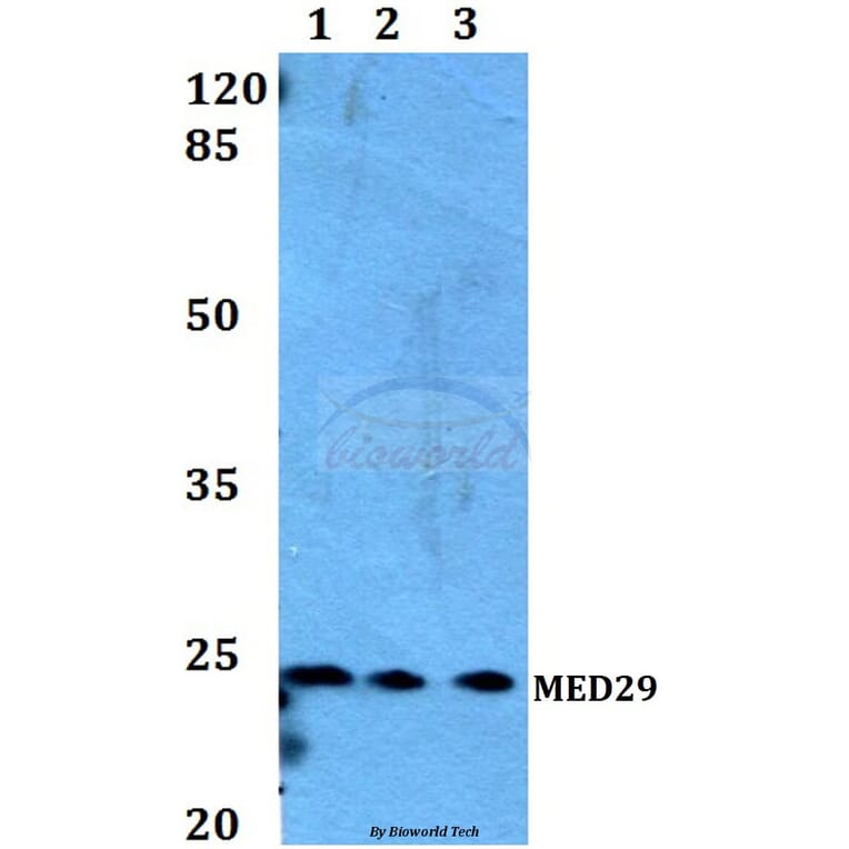 Anti-MED29 Antibody from Bioworld Technology (BS60174) - Antibodies.com