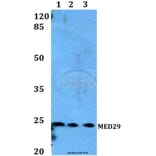 Anti-MED29 Antibody from Bioworld Technology (BS60174) - Antibodies.com