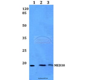 Anti-MED30 Antibody from Bioworld Technology (BS60175) - Antibodies.com