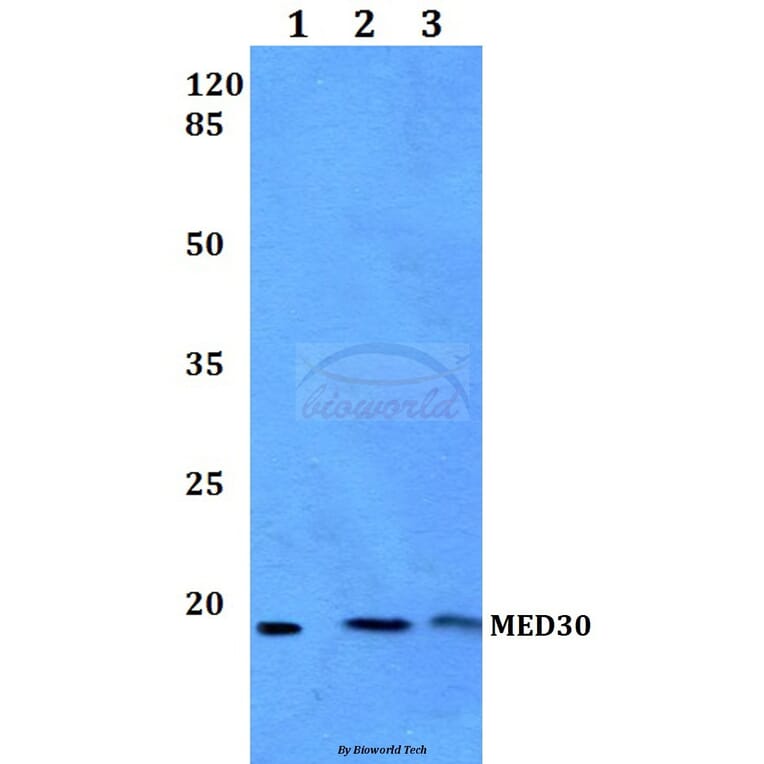 Anti-MED30 Antibody from Bioworld Technology (BS60175) - Antibodies.com
