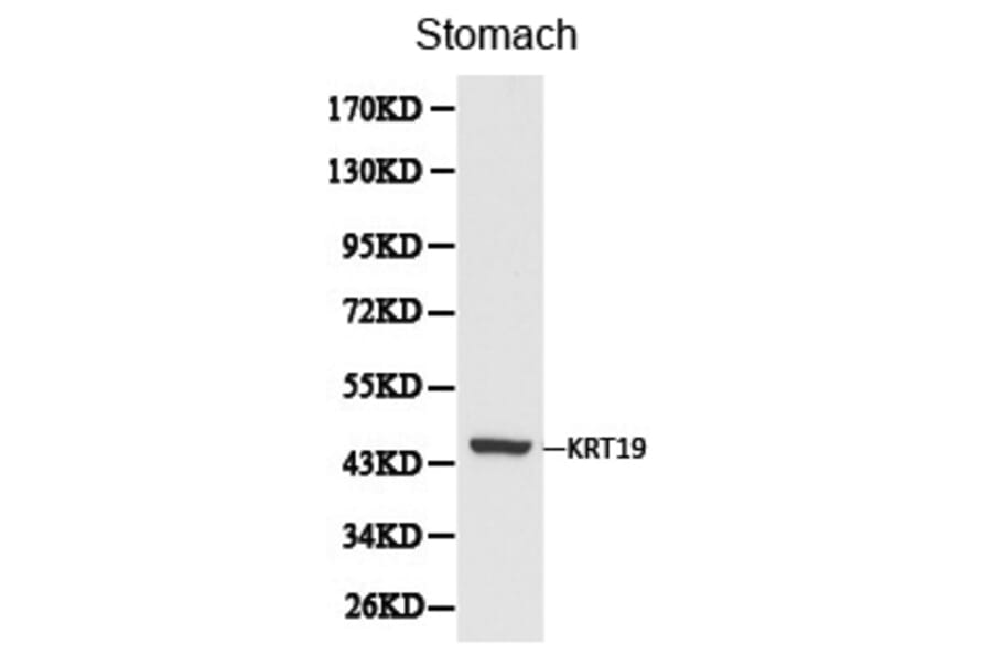 Anti-Cytokeratin 19 Antibody from Bioworld Technology (BS6018) - Antibodies.com