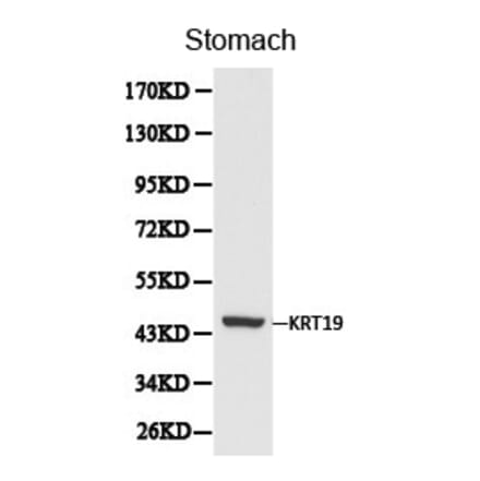 Anti-Cytokeratin 19 Antibody from Bioworld Technology (BS6018) - Antibodies.com