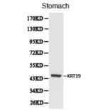 Anti-Cytokeratin 19 Antibody from Bioworld Technology (BS6018) - Antibodies.com