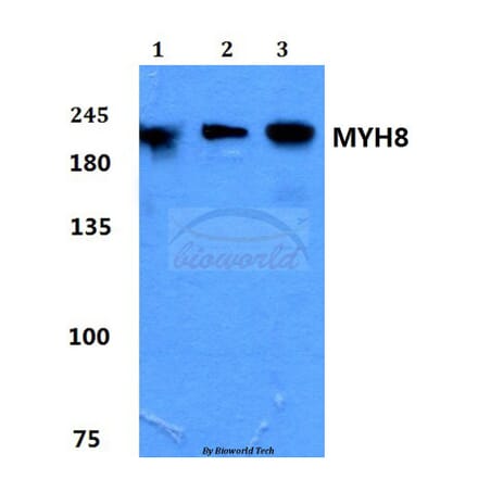Anti-Myosin-8 Antibody from Bioworld Technology (BS60181) - Antibodies.com