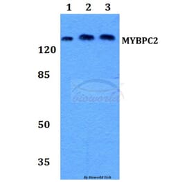 Anti-MYBPC2 Antibody from Bioworld Technology (BS60182) - Antibodies.com