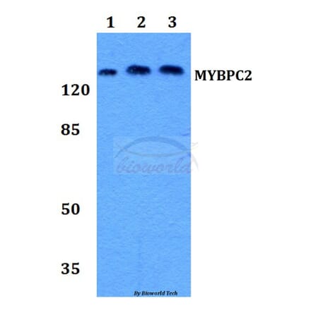 Anti-MYBPC2 Antibody from Bioworld Technology (BS60182) - Antibodies.com