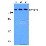 Anti-MYBPC2 Antibody from Bioworld Technology (BS60182) - Antibodies.com