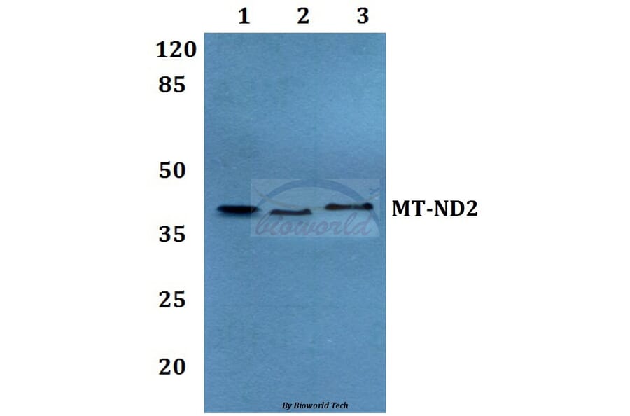 Anti-MT-ND2 Antibody from Bioworld Technology (BS60187) - Antibodies.com