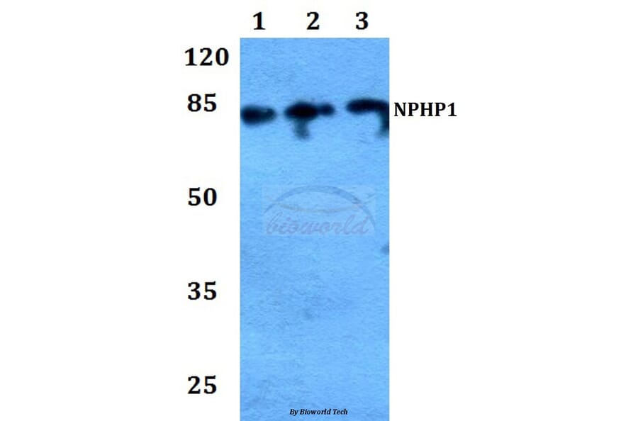 Anti-Nephrocystin-1 Antibody from Bioworld Technology (BS60189) - Antibodies.com