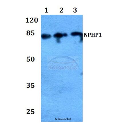 Anti-Nephrocystin-1 Antibody from Bioworld Technology (BS60189) - Antibodies.com