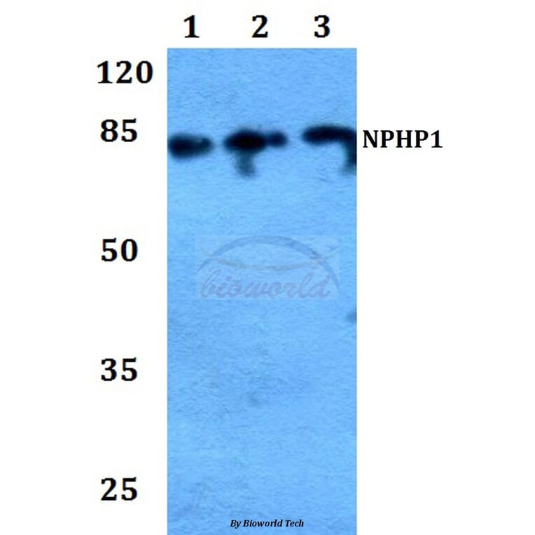 Anti-Nephrocystin-1 Antibody from Bioworld Technology (BS60189) - Antibodies.com