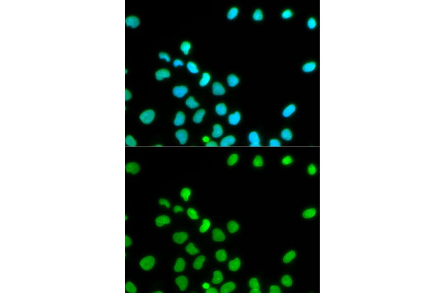 Anti-Lamin A Antibody from Bioworld Technology (BS6019) - Antibodies.com