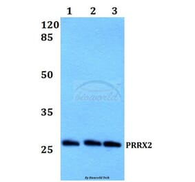 Anti-PRRX2 Antibody from Bioworld Technology (BS60199) - Antibodies.com