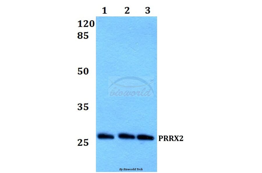 Anti-PRRX2 Antibody from Bioworld Technology (BS60199) - Antibodies.com