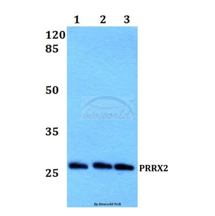 Anti-PRRX2 Antibody from Bioworld Technology (BS60199) - Antibodies.com