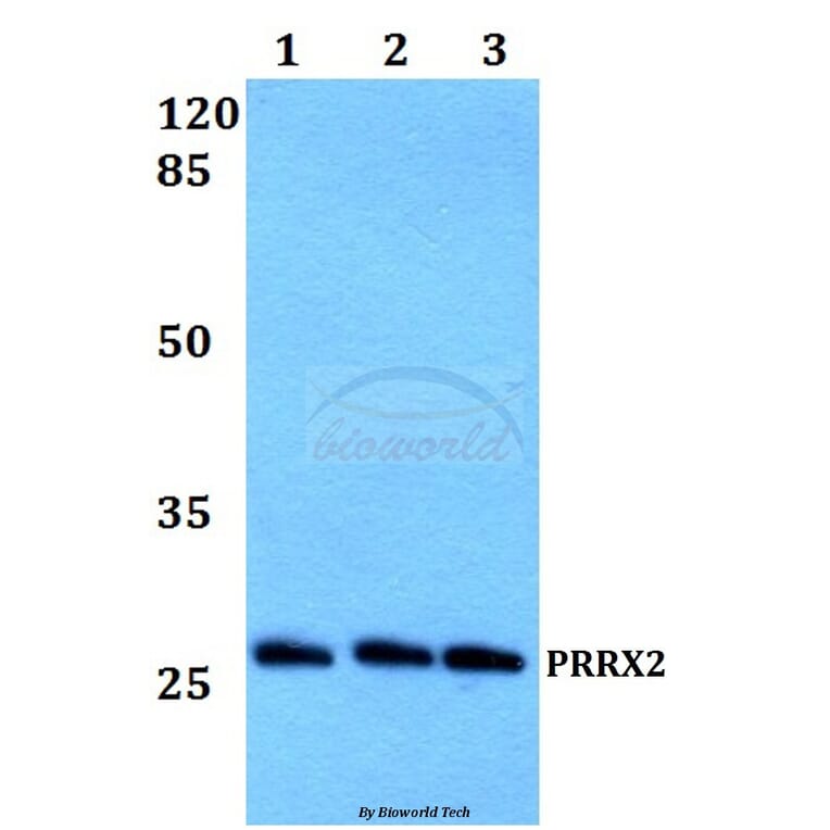 Anti-PRRX2 Antibody from Bioworld Technology (BS60199) - Antibodies.com