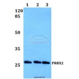 Anti-PRRX2 Antibody from Bioworld Technology (BS60199) - Antibodies.com