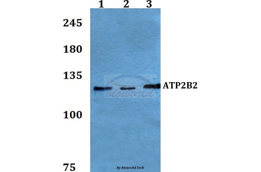 Anti-ATP2B2 Antibody from Bioworld Technology (BS60204) - Antibodies.com