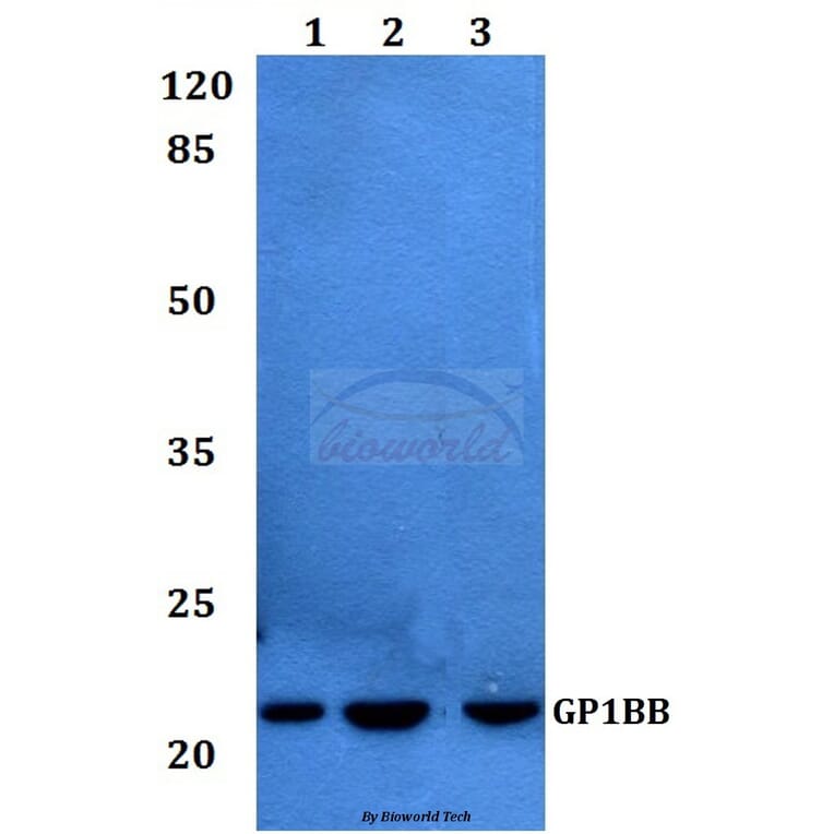 Anti-CD42c Antibody from Bioworld Technology (BS60205) - Antibodies.com