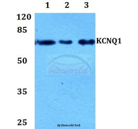 Anti-Kv7.1 Antibody from Bioworld Technology (BS60208) - Antibodies.com