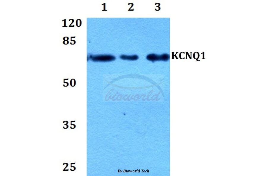 Anti-Kv7.1 Antibody from Bioworld Technology (BS60208) - Antibodies.com