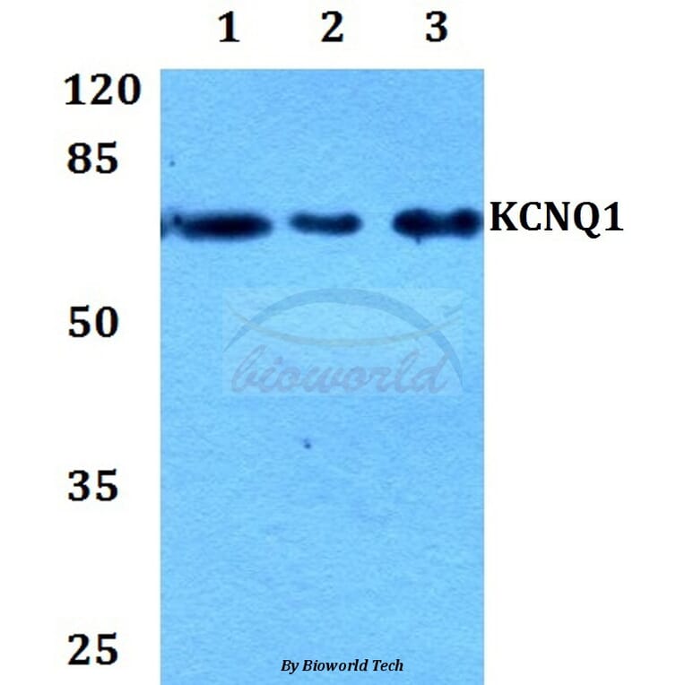 Anti-Kv7.1 Antibody from Bioworld Technology (BS60208) - Antibodies.com