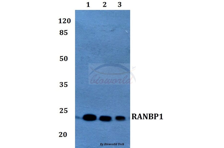 Anti-RANBP1 Antibody from Bioworld Technology (BS60214) - Antibodies.com