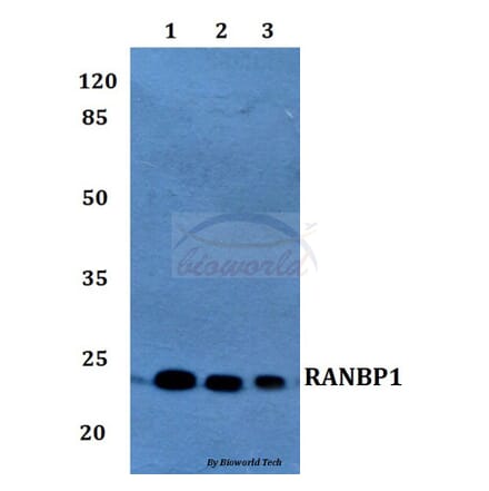 Anti-RANBP1 Antibody from Bioworld Technology (BS60214) - Antibodies.com