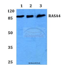 Anti-RASA4 Antibody from Bioworld Technology (BS60215) - Antibodies.com