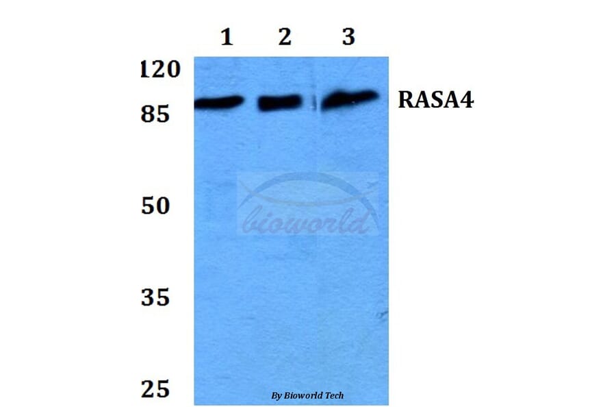 Anti-RASA4 Antibody from Bioworld Technology (BS60215) - Antibodies.com