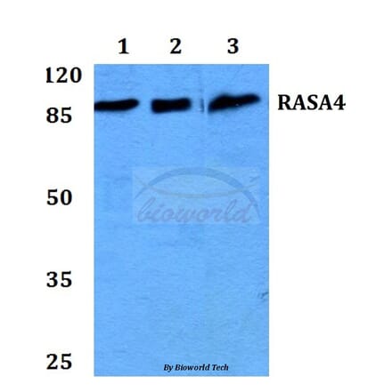 Anti-RASA4 Antibody from Bioworld Technology (BS60215) - Antibodies.com