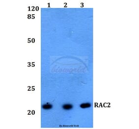 Anti-RAC2 Antibody from Bioworld Technology (BS60217) - Antibodies.com