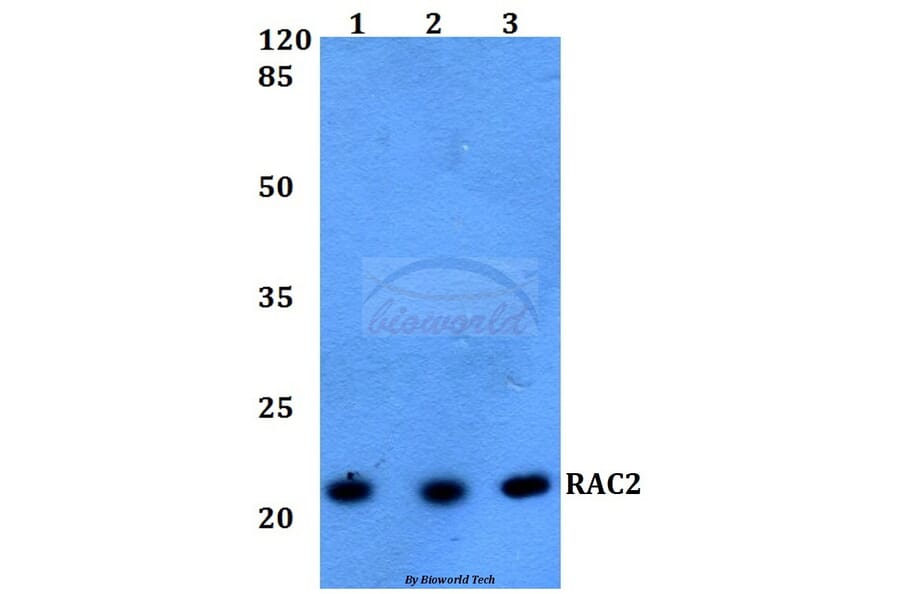Anti-RAC2 Antibody from Bioworld Technology (BS60217) - Antibodies.com