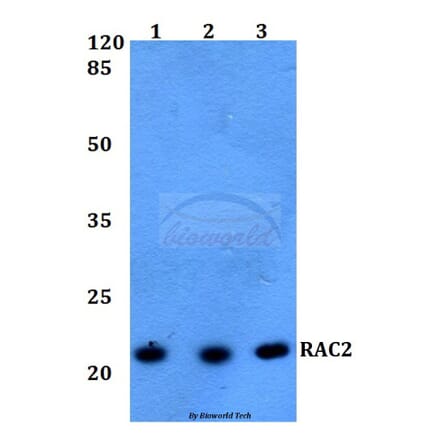 Anti-RAC2 Antibody from Bioworld Technology (BS60217) - Antibodies.com