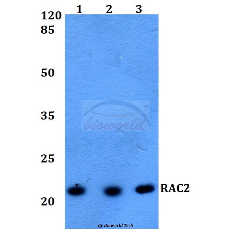 Anti-RAC2 Antibody from Bioworld Technology (BS60217) - Antibodies.com