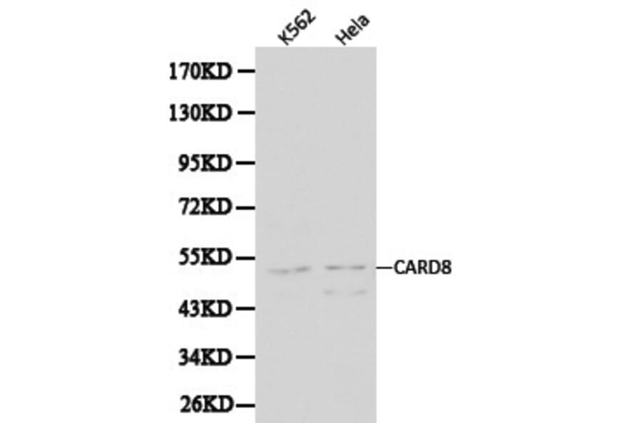 Anti-CARD8 Antibody from Bioworld Technology (BS6022) - Antibodies.com