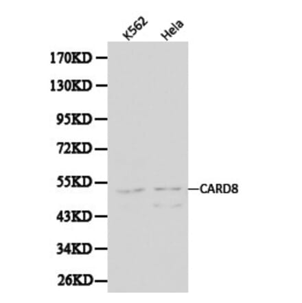 Anti-CARD8 Antibody from Bioworld Technology (BS6022) - Antibodies.com