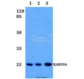 Anti-RAB39 Antibody from Bioworld Technology (BS60222) - Antibodies.com