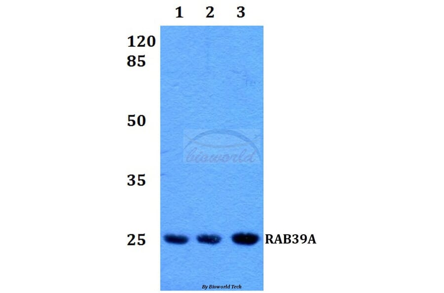 Anti-RAB39 Antibody from Bioworld Technology (BS60222) - Antibodies.com