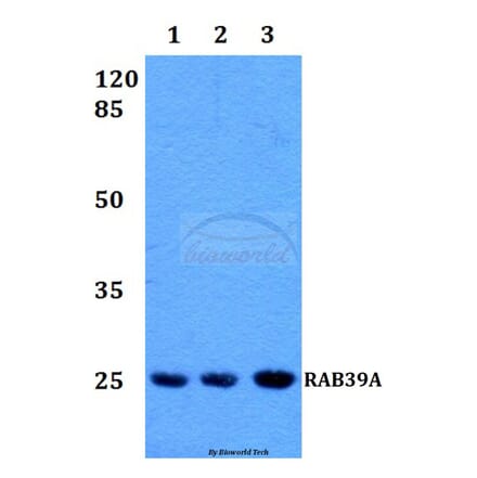 Anti-RAB39 Antibody from Bioworld Technology (BS60222) - Antibodies.com