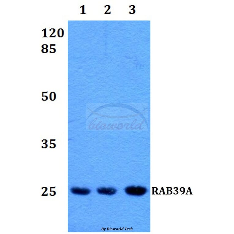 Anti-RAB39 Antibody from Bioworld Technology (BS60222) - Antibodies.com