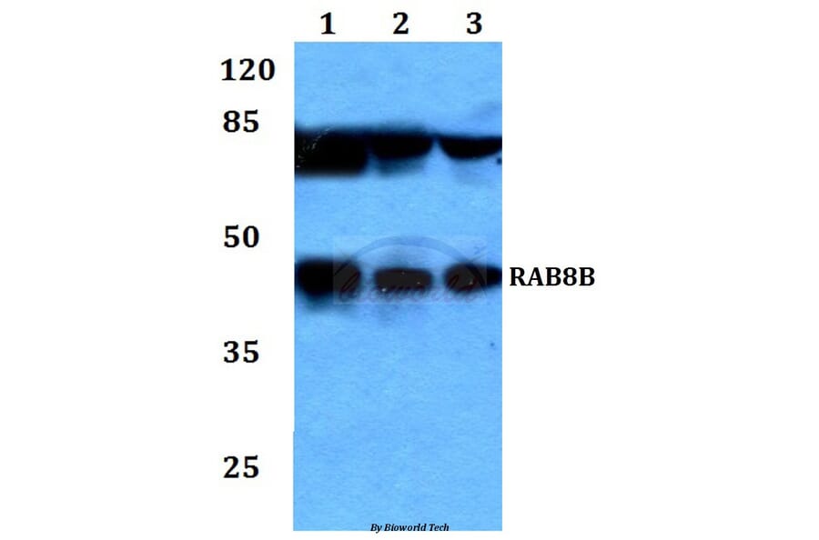 Anti-RAB8B Antibody from Bioworld Technology (BS60223) - Antibodies.com