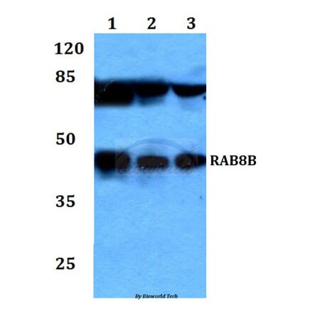 Anti-RAB8B Antibody from Bioworld Technology (BS60223) - Antibodies.com