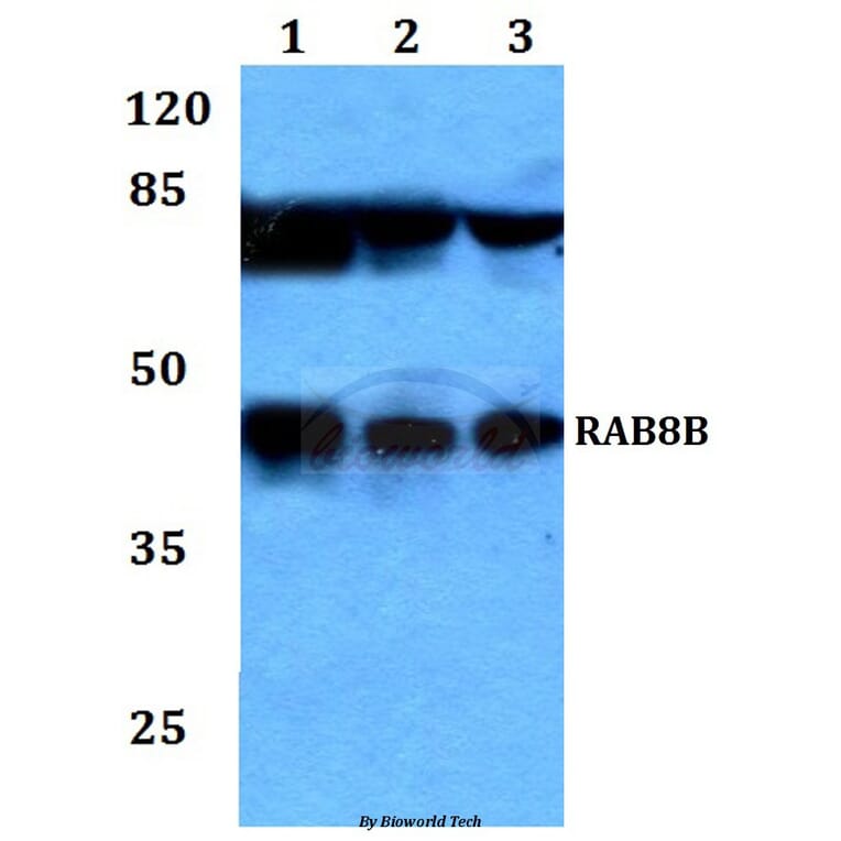 Anti-RAB8B Antibody from Bioworld Technology (BS60223) - Antibodies.com