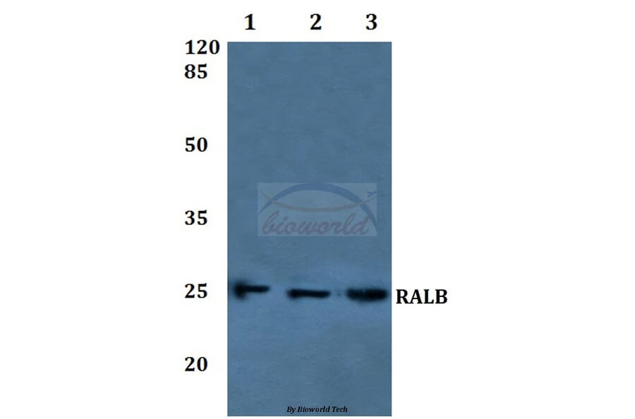 Anti-RALB Antibody from Bioworld Technology (BS60224) - Antibodies.com