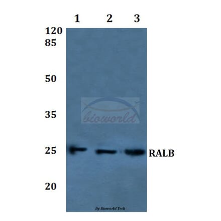 Anti-RALB Antibody from Bioworld Technology (BS60224) - Antibodies.com