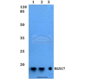 Anti-RGS17 Antibody from Bioworld Technology (BS60229) - Antibodies.com