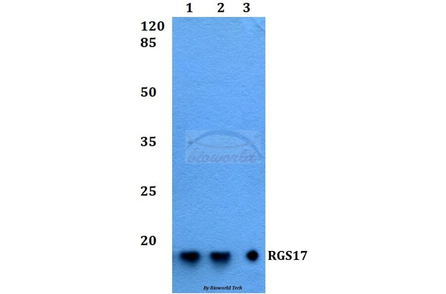 Anti-RGS17 Antibody from Bioworld Technology (BS60229) - Antibodies.com
