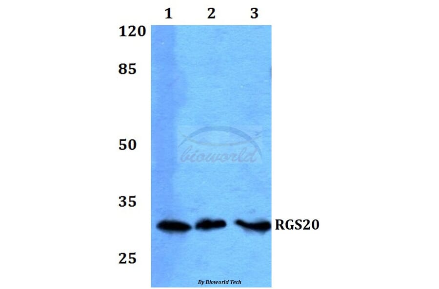 Anti-RGS20 Antibody from Bioworld Technology (BS60230) - Antibodies.com