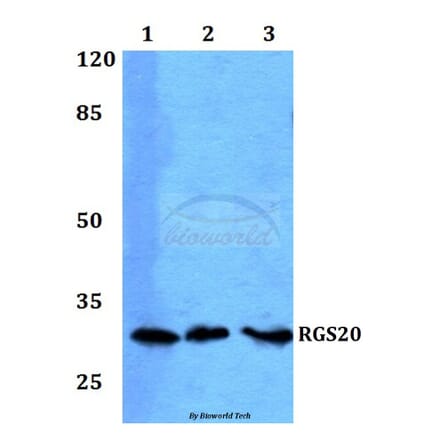 Anti-RGS20 Antibody from Bioworld Technology (BS60230) - Antibodies.com